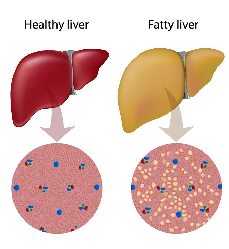 How to Treat Fatty – Is It Good? Is it worth it? Review